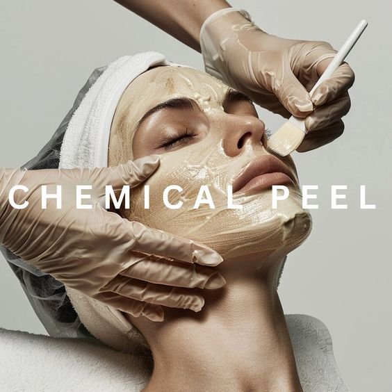 chemical peel treatment in chennai