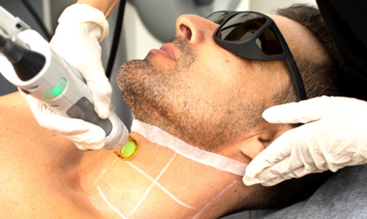 Laser Hair Removal