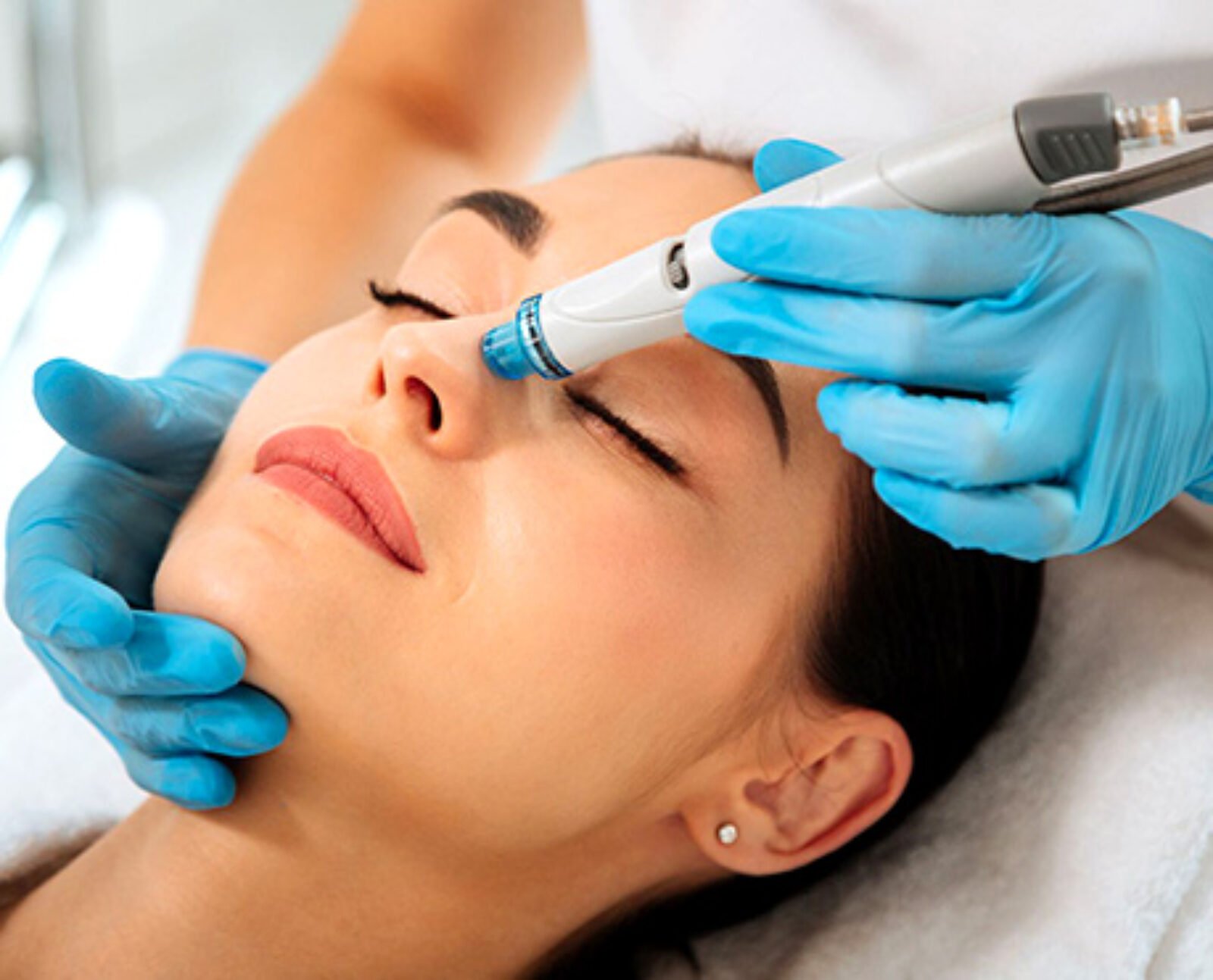 HydraFacial Benefits