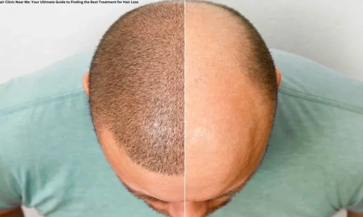 Hair Clinic Near Me Your Ultimate Guide to Finding the Best Treatment for Hair Loss