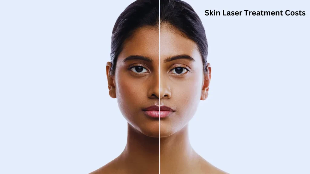 Skin Laser Treatment Costs