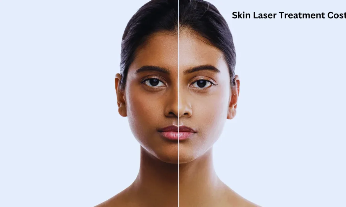 Skin Laser Treatment Costs